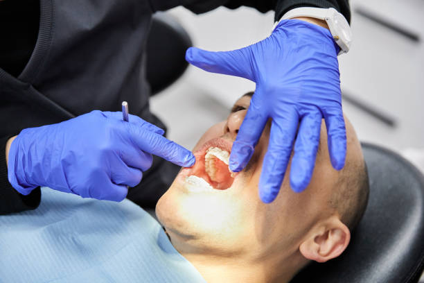 Best Emergency Tooth Extraction in Dripping Springs, TX